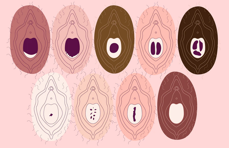 Variability of the hymen in different women