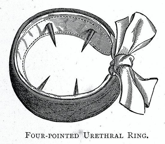 Toothed urethral ring designed to prevent masturbation